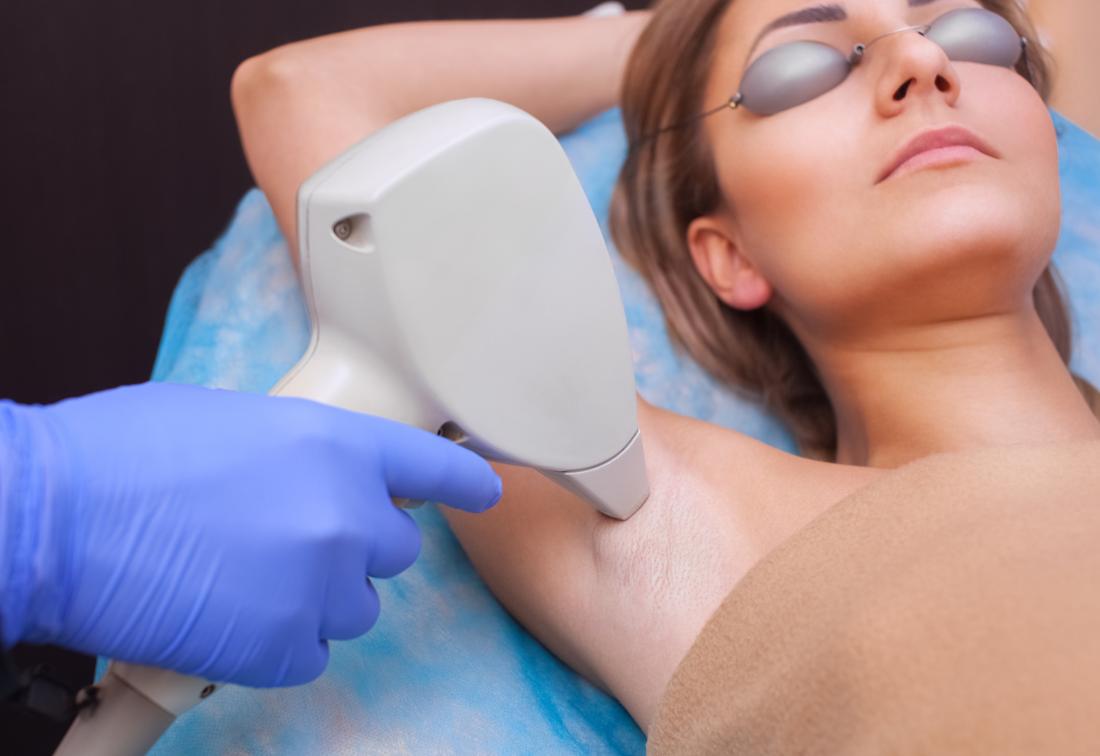 laser hair removal cost and price