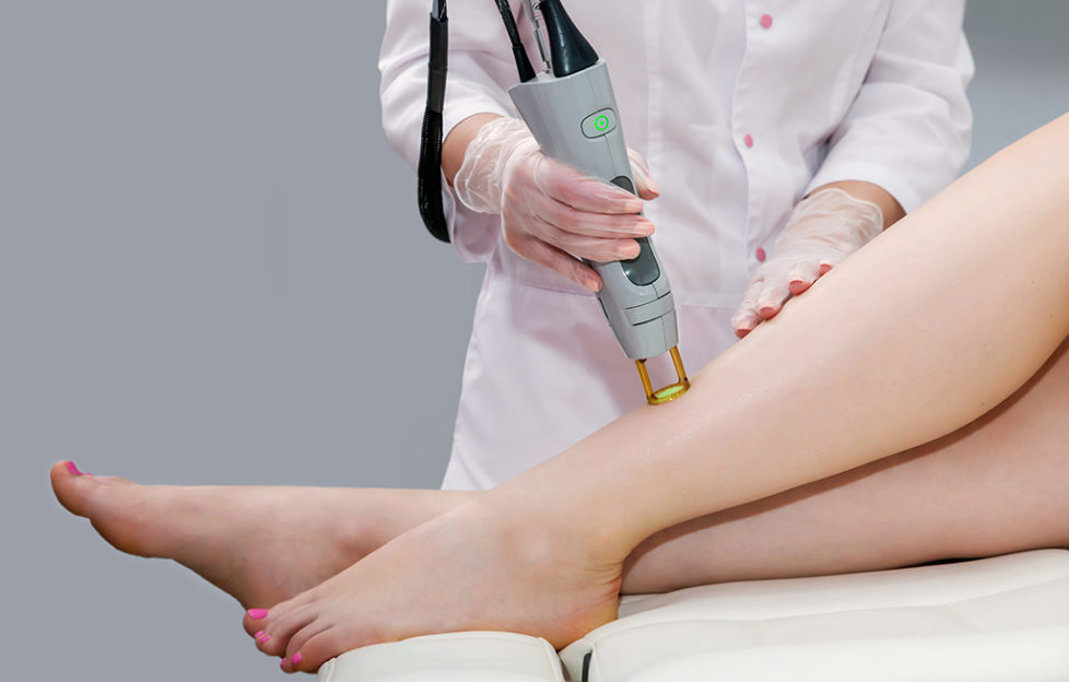 how permanent is laser hair removal